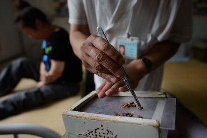 La medicina tradicional china usa aguijones de abeja contra el cáncer.