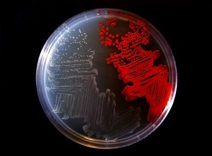 Un cultivo de bacterias en laboratorio.