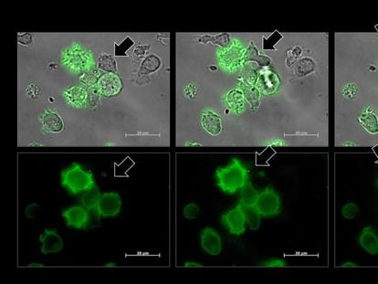Una célula NK, señalada por una flecha, se vuelve verde tras robar un fragmento de la membrana de una célula cancerosa, también verde.