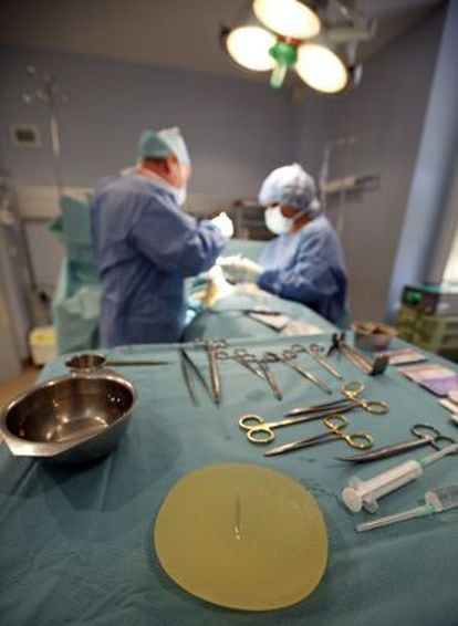 Implante mamario defectuoso, tras ser retirado de una paciente en una clínica de Niza.
