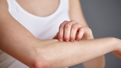 Auge de casos de tiña y sarna: la detectivesca labor de los dermatólogos por investigar su origen