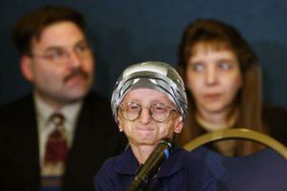 John Tacket, una persona con progeria que falleció en 2004