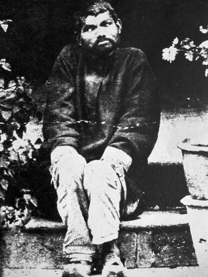 El niño lobo, Dina Sanichar, en 1875, tres años después de ser descubierto.