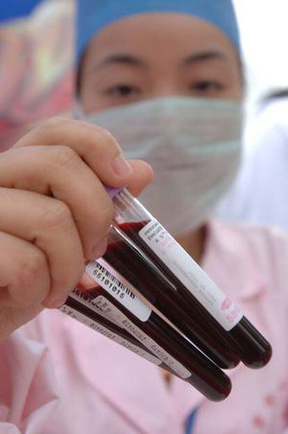 Muestras de células madre donadas por voluntarios en China.