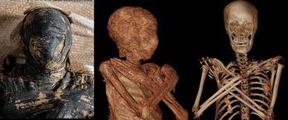 Tres imágenes del estudio de la momia. 