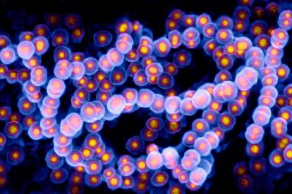 Imagen tomada a través del microscopio del 'Streptococcus pyogenes'.