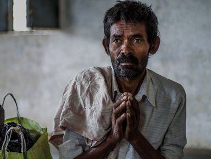 Venkatesh, de 45 años, enfermo de tuberculosis en Htpalli (India).