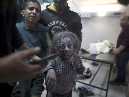 Dos niños heridos llegan al hospital Nasser, en Jan Yunis, este jueves, tras uno de los bombardeos israelíes en el sur de Gaza.