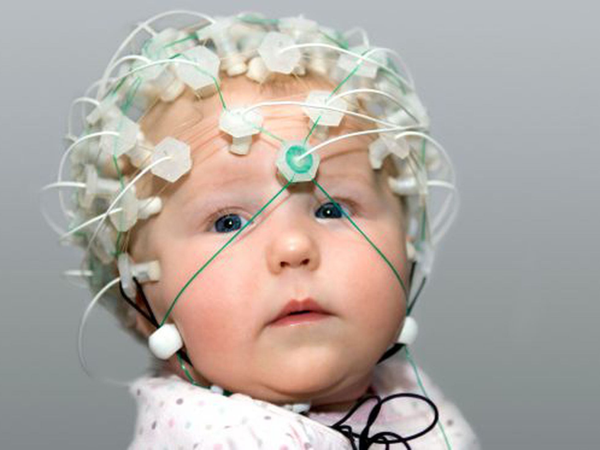 Ээг фото. Электроэнцефалография (ЭЭГ). ЭЭГ И Эхо ЭГ что это. ЭЭГ головного мозга ребенку. Эхоэнцефалография (Эхо ЭГ) головного мозга.