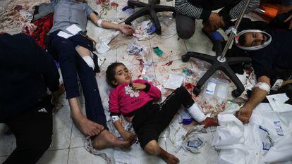 Varios niños palestinos heridos en el bombardeo israelí de una escuela en Jan Yunis, yacen en el suelo del hospital Nasser, este martes en Gaza.