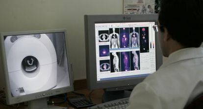 Un profesional realiza una tomografíen el Instituto PET Doctor Carreras