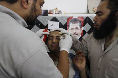 Un partidario de Mohamed Morsi es atendido por personal sanitario en un hospital de El Cairo tras el tiroteo la pasada madrugada en el exterior de la sede de la Guardia Republicana, 8 de julio de 2013.