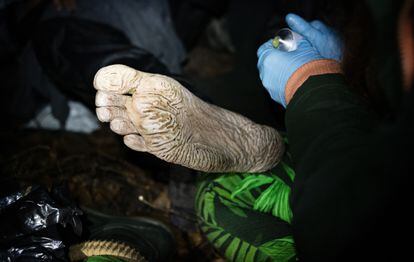 El pie de trinchera es una infección por hongos.