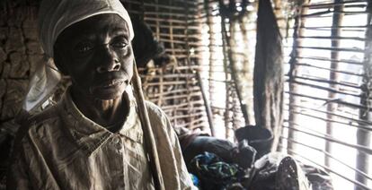 Jetou Mapuani perdió la vista a causa de la oncocercosis y su marido la abandonó.