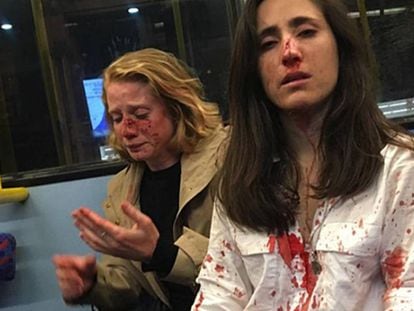 Melania Geymonat (derecha) y su novia, Chris, tras la agresión que sufrieron en un autobús de Londres el 30 de mayo. En vídeo, la pareja narra cómo fue la agresión.