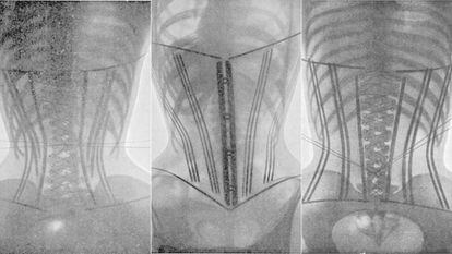 Radiografías tomadas por Wilhelm Röntgen de mujeres con corsé.