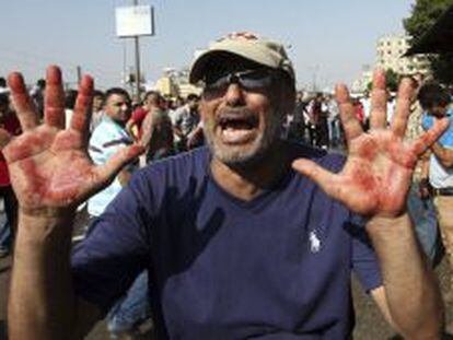 Un manifestante muestra sus manos ensangrentadas durante choques entre simpatizantes de los Hermanos Musulmanes del depuesto presidente egipcio Mohamed Mursi y la polic&iacute;a, cerca de la plaza de Rams&eacute;s, en El Cairo (Egipto), hoy, viernes 16 de agosto de 2013. M&aacute;s de 30 personas murieron hoy en los choques entre partidarios y detractores de Mursi en el barrio de Rams&eacute;s, en el centro de El Cairo, seg&uacute;n los Hermanos Musulmanes. EFE/Khaled Elfiqi