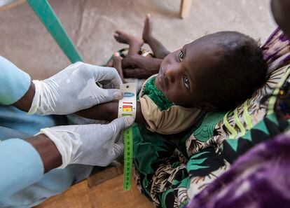 Un sanitario mide el brazo de un niño para chequear la desnutrición mientras su madre, Theoula Louma, lo sostiene en una clínica administrada por la ONG Concern en el campamento de Baga Sola, Chad.