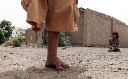 Dos niños yemeníes cuyas piernas fueron amputadas después de ser lesionados por minas terrestres en Adén, ciudad yemení controlada por el Gobierno.