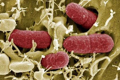 Imagen tomada por un microscopio de una bacteria tipo EHEC, cepa peligrosa de la 'Escherichia coli', facilitada por el Centro de Investigación de Infecciones Helmhotz