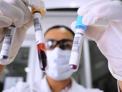 Una bióloga sanitaria del Hospital General de Atlacomulco (México), con una muestra de sangre para hacer la prueba de coronavirus.