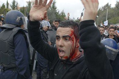 Uno de los jóvenes heridos en las protestas.