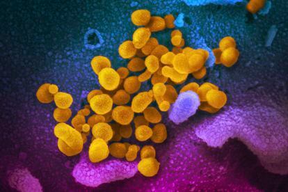 Imagen de virus SARS-CoV-2 (en amarillo) tomada con un microscopio electrónico al comienzo de la pandemia.