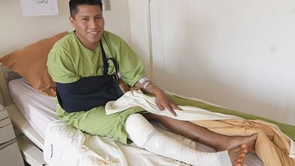 Erwin Tumiri se recupera, en una clínica de Cochabamba, de los golpes que sufrió en un accidente de carretera.