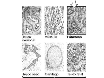 Células madre para curar la diabetes