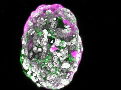 Modelo de embrión humano (a los ocho días) creado en el laboratorio del científico palestino Jacob Hanna, del Instituto Weizmann de Ciencias.