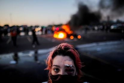 Rachel Pérez aparece en la foto con hematomas alrededor del ojo, heridas sufridas por balas de goma durante las protestas por la muerte del afroamericano George Floyd, en Minneapolis (EE UU), el 28 de mayo de 2020.