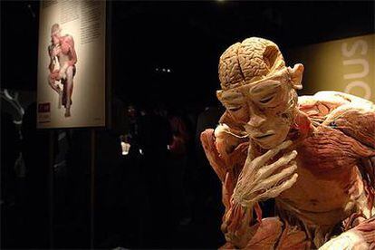 Uno de los cuerpos expuestos en <i>Bodies... The Exhibition</i>, en la que se pueden ver 22 cuerpos humanos completos además de 260 órganos vitales.
