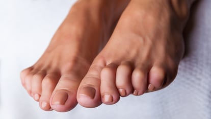 Se trata de un artículo de EL PAÍS Escaparate que describe la deformidad denominada "dedos en garra del pie".