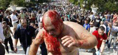Un hombre cubierto con su propia sangre escapa después de que un grupo de manifestantes de izquierda lo acusaran de fascista y trataran de lincharlo durante una protesta en Atenas