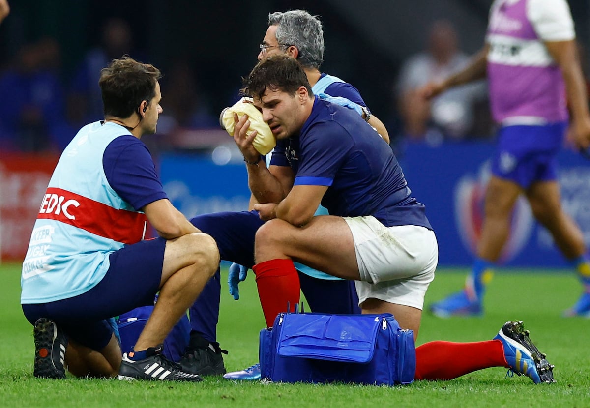 Francia pierde al mago Dupont en un partido que gana 96-0 | Deportes