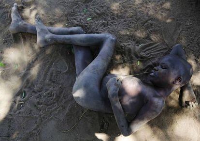 Una de las víctimas del síndrome del cabeceo, en Kitgum (Uganda).