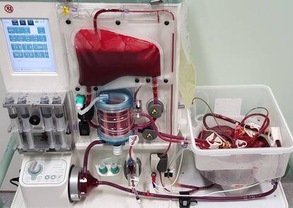 Un hígado donado en la máquina de perfusión normotérmica 'OrganOx'.