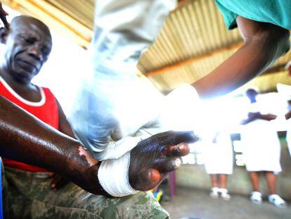 Un paciente de lepra es tratado en el  Hopital de la Rive de Kinshasa, en la República Democrática de Congo.  