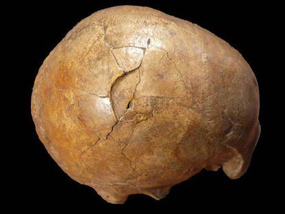 Una cráneo fracturado de hace 33.000 años hallado en Transilvania atestigua la violencia en la antiguedad. / 