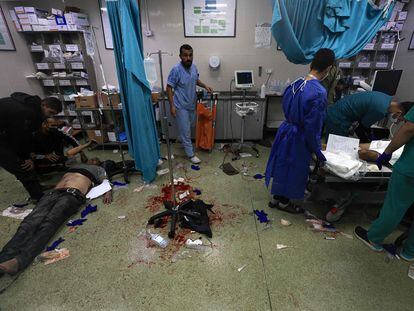 Personal sanitario trabajan este domingo en el hospital de Nasser tras un bombardeo israelí sobre Jan Yunis.
