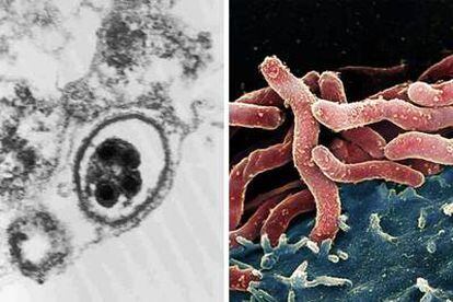 Imágenes del virus del herpes asociado con el sarcoma de Kaposi (izquierda) y de la bacteria <i>Helicobacter pylori,</i> que causa linfomas y úlceras de estómago.