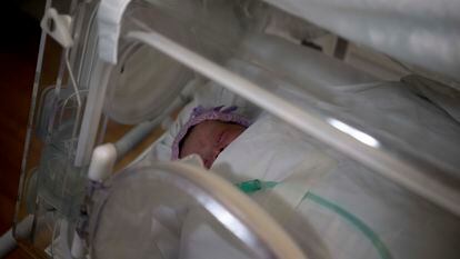 Ivanna, de un mes de vida, en una incubadora luego de recibir tratamiento por retinopatía.