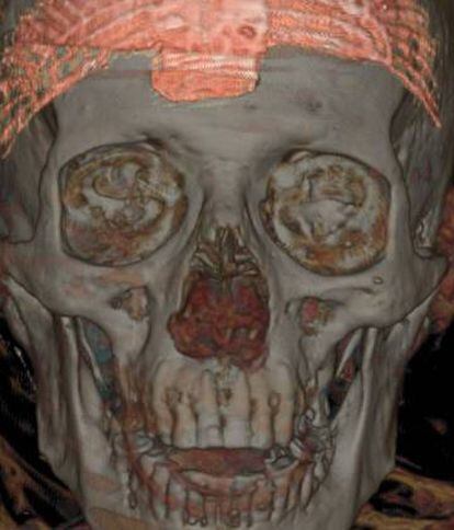 Tomografía de la momia de Nespamedu.