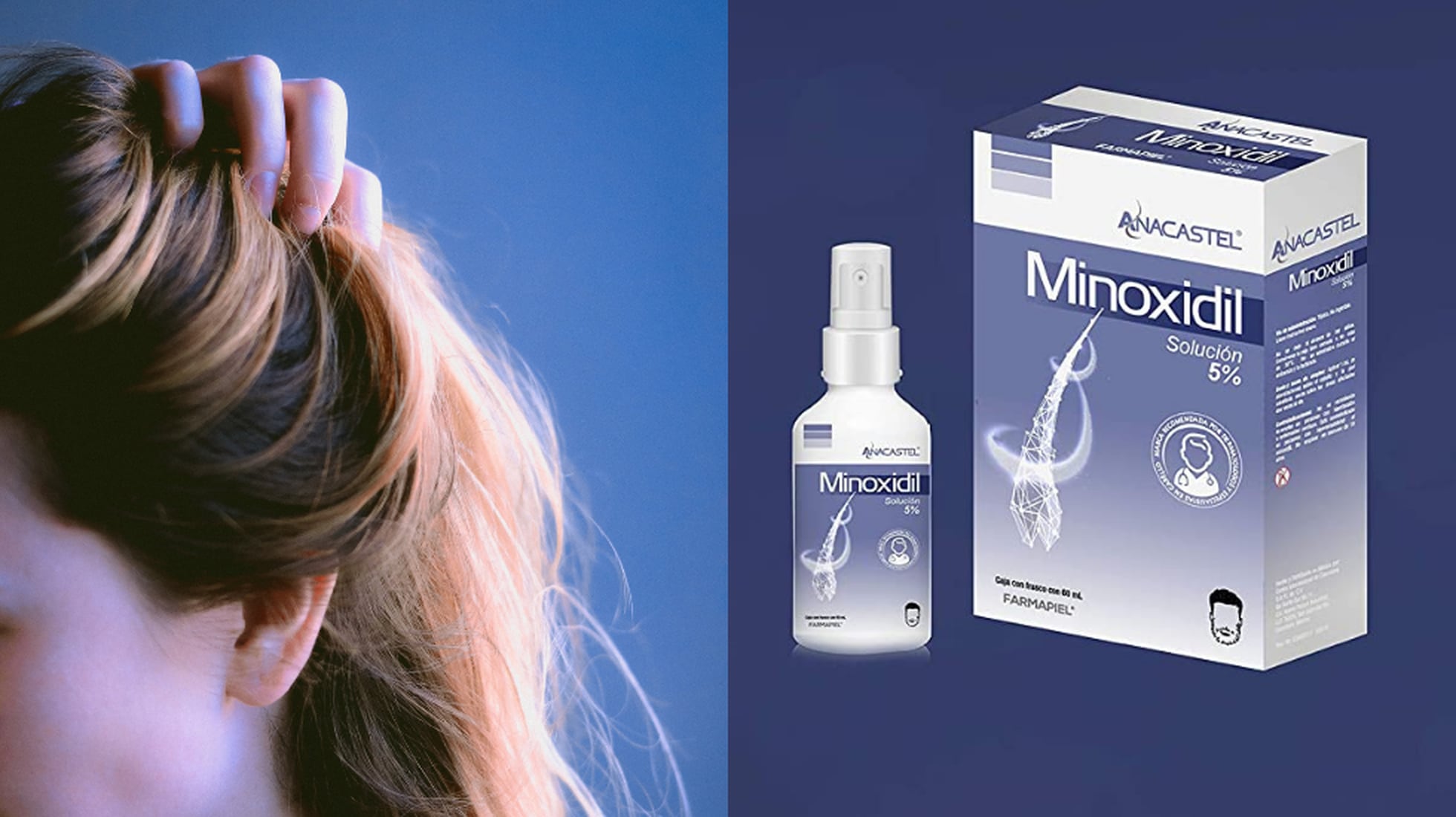 Así es el para la caída del cabello Minoxidil favorito de Amazon | | EL PAÍS México