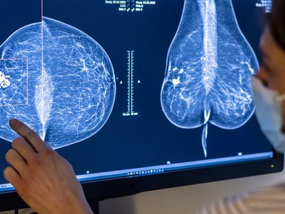 Personal sanitario analiza una mamografía en un hospital de Berlín, en Alemania.