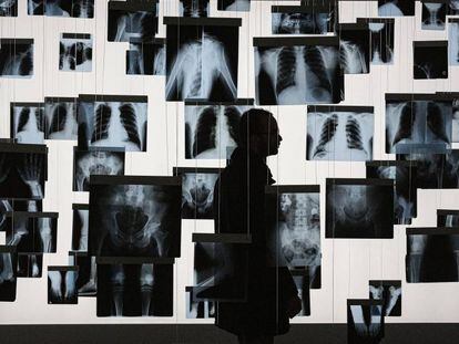 Un visitant passeja per l'exposició ‘Universal. La salut a Catalunya’, al Palau Robert.