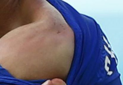 Chiellini muestra la marca de los dientes de Suárez, tras el mordisco.
