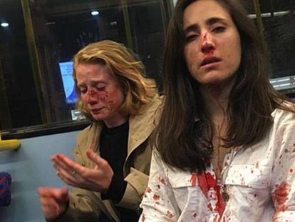 Melania Geymonat (d.) y su novia, tras la agresión que sufrieron en un autobús de Londres el 30 de mayo. En vídeo, la pareja narra cómo fue la agresión.