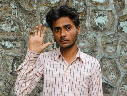 Hasiruddin Ansari, enfermo de lepra, vive en Bombay.