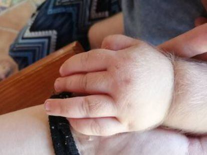 Sanidad confirma que la compañía vendió por error un vasodilatador indicado para la alopecia como si fuera omeprazol a granel